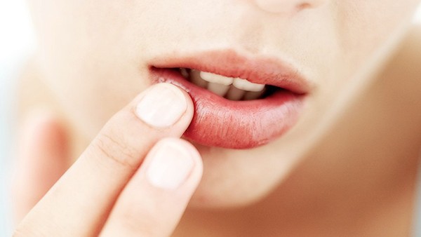 Son môi giả có thể gây vô sinh